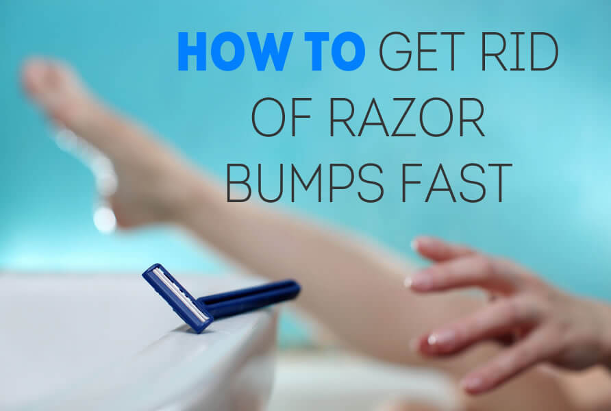 15 How To Get Rid Of Razor Bumps And Burns Go Itch Free