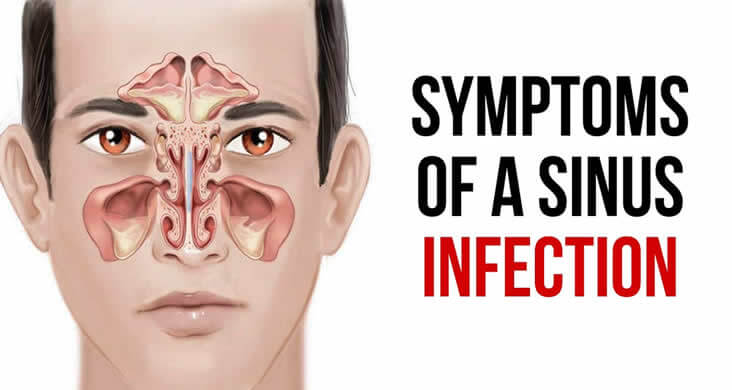 Know In Details About The Symptoms Causes And Treatment For Sinus 